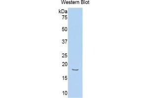 WB of Protein Standard: different control antibodies against Highly purified E. (Hemopexin CLIA Kit)