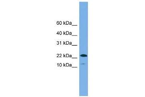 WFDC1 antibody used at 1 ug/ml to detect target protein. (WFDC1 抗体  (N-Term))