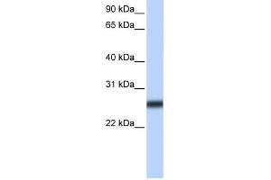 TMPRSS5 antibody used at 2 ug/ml to detect target protein. (TMPRSS5 抗体)