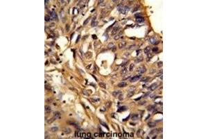 Immunohistochemistry (IHC) image for anti-Electron-Transferring-Flavoprotein Dehydrogenase (ETFDH) antibody (ABIN3002851) (ETFDH 抗体)