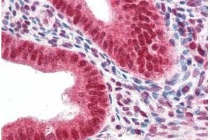 Human Uterus (formalin-fixed, paraffin-embedded) stained with CBX5 antibody ABIN337121 at 2. (CBX5 抗体  (AA 88-102))