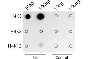 Dot-blot analysis of all sorts of peptides using Acetyl-Histone H4-K5 antibody (ABIN7267743) at 1:1000 dilution. (Histone H4 抗体  (acLys5))