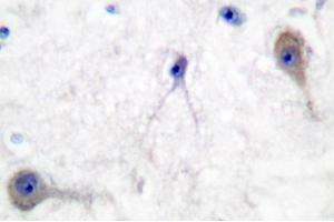 Image no. 1 for anti-Patched 1 (PTCH1) antibody (ABIN271777) (Patched 1 抗体)