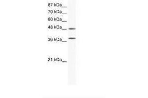 Image no. 1 for anti-Mitogen-Activated Protein Kinase 14 (MAPK14) (C-Term) antibody (ABIN203076) (MAPK14 抗体  (C-Term))