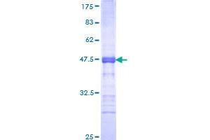 CTCFL Protein (AA 193-293) (GST tag)