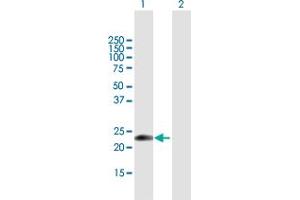 Western Blot analysis of EDN1 expression in transfected 293T cell line by EDN1 MaxPab polyclonal antibody. (Endothelin 1 抗体  (AA 1-212))
