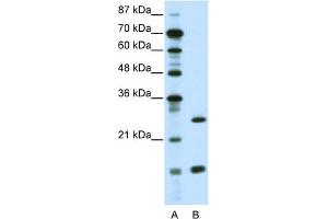 WB Suggested Anti-CEBPG Antibody Titration:  0. (CEBPG 抗体  (N-Term))