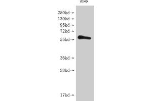 Western blot All lanes: IFNLR1 antibody at 3. (IL28RA 抗体  (AA 21-228))