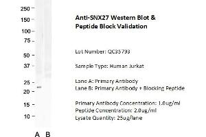 Host: Rabbit Target Name: SNX27 Sample Type: Human Jurkat  Lane A: Primary Antibody  Lane B: Primary Antibody + Blocking Peptide  Primary Antibody Concentration: 1. (SNX27 抗体  (C-Term))