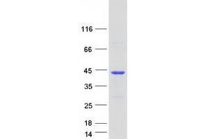 Western Blotting (WB) image for Clusterin Associated Protein 1 (CLUAP1) (Transcript Variant 2) protein (Myc-DYKDDDDK Tag) (ABIN2712888)