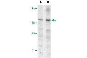 Western blot analysis of Casp12 (small) in mouse (lane A) and rat (lane B) liver lysate with Casp12 small polyclonal antibody  at 1 ug/mL . (Caspase 12 抗体)