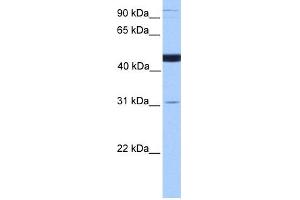 WB Suggested Anti-SCCPDH Antibody Titration: 0. (SCCPDH 抗体  (C-Term))