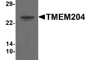 Western blot analysis of TMEM204 in human brain tissue lysate with TMEM204 antibody at 1 µg/mL . (TMEM204 抗体  (C-Term))
