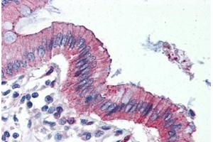 Human Colon (formalin-fixed, paraffin-embedded) stained with TJP3 antibody ABIN364296 at 10 ug/ml followed by biotinylated goat anti-rabbit IgG secondary antibody ABIN481713, alkaline phosphatase-streptavidin and chromogen. (TJP3 抗体  (C-Term))