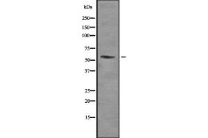 Western blot analysis of TRalpha using SKOV3 whole cell lysates (THRA 抗体  (N-Term))