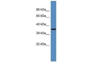 Western Blot showing Gm5581 antibody used at a concentration of 1. (Gm5581 抗体  (N-Term))