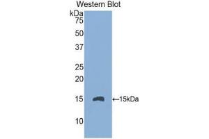 Western Blotting (WB) image for anti-Endoglin (ENG) (AA 336-450) antibody (ABIN1174025) (Endoglin 抗体  (AA 336-450))