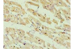 Immunohistochemistry of paraffin-embedded human heart tissue using ABIN7144868 at dilution of 1:100 (ATP5O 抗体  (AA 24-213))