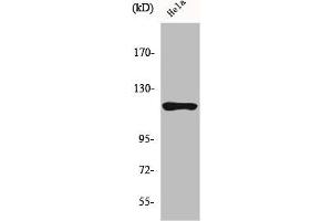 Western Blot analysis of HeLa cells using HXK I Polyclonal Antibody (Hexokinase 1 抗体  (N-Term))