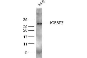 Mouse lung lysates probed with Rabbit Anti-IGFBP7 Polyclonal Antibody, Unconjugated  at 1:500 for 90 min at 37˚C. (IGFBP7 抗体  (AA 131-230))