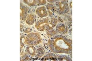 Immunohistochemistry (IHC) image for anti-Cellular Retinoic Acid Binding Protein 1 (CRABP1) antibody (ABIN3002339) (CRABP1 抗体)