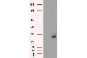 Western Blotting (WB) image for anti-Serine Racemase (SRR) antibody (ABIN1501137) (SRR 抗体)