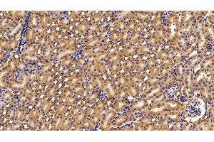 Detection of FGFR1 in Mouse Kidney Tissue using Polyclonal Antibody to Fibroblast Growth Factor Receptor 1 (FGFR1) (FGFR1 抗体  (AA 236-362))
