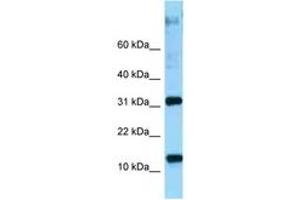 Image no. 1 for anti-Ribosomal Protein L22 (RPL22) (AA 73-122) antibody (ABIN6748251) (RPL22 抗体  (AA 73-122))