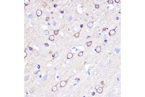 Immunohistochemistry of paraffin-embedded rat brain using Stathmin 1 Rabbit pAb (ABIN3023126, ABIN3023127, ABIN3023128 and ABIN6219402) at dilution of 1:100 (40x lens). (Stathmin 1 抗体  (AA 1-149))