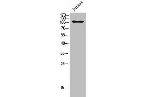 Western Blot analysis of Jurkat cells using GPRC6A Polyclonal Antibody (GPRC6A 抗体  (Internal Region))