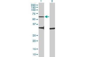 Western Blot analysis of GPR176 expression in transfected 293T cell line by GPR176 MaxPab polyclonal antibody. (GPR176 抗体  (AA 1-515))