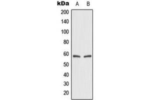 Western blot analysis of GLUT2 expression in HEK293T (A), rat kidney (B) whole cell lysates. (SLC2A2 抗体  (Center))