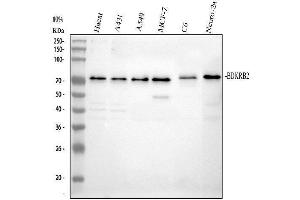 anti-Bradykinin Receptor B2 (BDKRB2) (AA 357-391), (C-Term) antibody