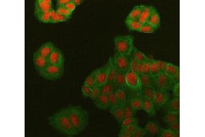 IF analysis of Symplekin/SYMPK using anti-Symplekin/SYMPK antibody (ABIN7601558) and anti-Tubulin Alpha antibody (ABIN7600339).