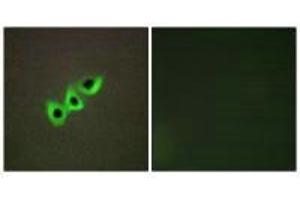 Immunofluorescence analysis of A549 cells, using RHG07 antibody. (DLC1 抗体)