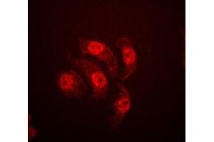 Immunofluorescent analysis of ETS1 (pT38) staining in Jurkat cells.