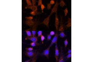 Immunofluorescence analysis of NIH-3T3 cells using VPS26A Polyclonal Antibody  at dilution of 1:100 (40x lens). (VPS26A 抗体  (AA 208-327))