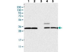 Western blot analysis of Lane 1: RT-4, Lane 2: U-251 MG, Lane 3: Human Plasma, Lane 4: Liver, Lane 5: Tonsil with UBE3D polyclonal antibody  at 1:250-1:500 dilution. (UBE3D 抗体)