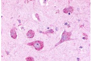 Anti-LPHN3 antibody  ABIN1049027 IHC staining of human brain, neurons. (LPHN3 抗体  (C-Term))
