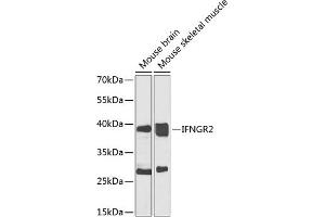 Western blot analysis of extracts of various cell lines, using IFNGR2 antibody (ABIN6134792, ABIN6142200, ABIN6142202 and ABIN6223464) at 1:1000 dilution. (IFNGR2 抗体  (C-Term))
