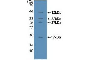 Detection of Recombinant GAB1, Human using Polyclonal Antibody to GRB2 Associated Binding Protein 1 (GAB1) (GAB1 抗体  (AA 394-656))