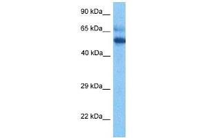 Host:  Rabbit  Target Name:  ESCO2  Sample Tissue:  Thymus Tumor lysates  Antibody Dilution:  1ug/ml (ESCO2 抗体  (Middle Region))