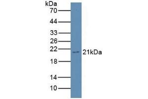 Detection of GKN3 in Rat Stomach Tissue using Polyclonal Antibody to Gastrokine 3 (GKN3) (Gastrokine 3 抗体  (AA 38-177))