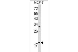 Western blot analysis of ARF3 antibody (Center D93) (ABIN390530 and ABIN2840877) in MCF-7 cell line lysates (35 μg/lane). (ARF3 抗体  (AA 78-106))