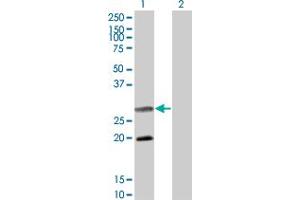 Western Blot analysis of DIABLO expression in transfected 293T cell line by DIABLO monoclonal antibody (M02), clone 4F9. (DIABLO 抗体  (AA 119-218))