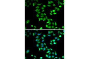 Immunofluorescence analysis of HeLa cell using PDCD6 antibody. (PDCD6 抗体)