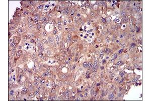 Immunohistochemistry (IHC) image for anti-DIS3-Like Exonuclease 2 (DIS3L2) (AA 27-250) antibody (ABIN1724900)
