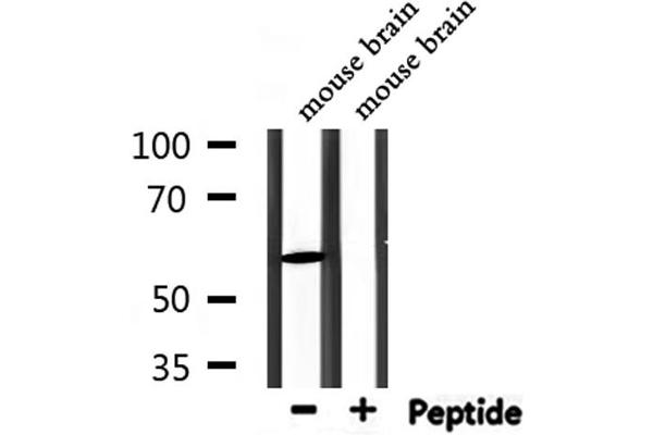PDP2 Antikörper  (N-Term)