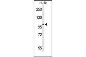 Western blot analysis of LIPE Antibody (C-term) in HL-60 cell line lysates (35ug/lane). (LIPE 抗体  (C-Term))