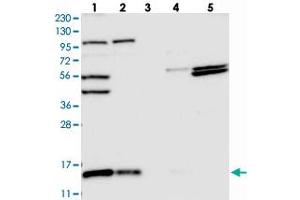 Western blot analysis of Lane 1: RT-4, Lane 2: U-251 MG, Lane 3: Human Plasma, Lane 4: Liver, Lane 5: Tonsil with FAM136A polyclonal antibody  at 1:250-1:500 dilution. (FAM136A 抗体)